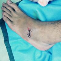 ask-your-dentist-here-merged-thread-drg-edy-and-zusans-imran