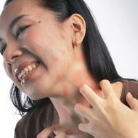 daftar-penyakit-keturunan