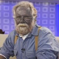 pria-berkulit-biru-ini-meninggal