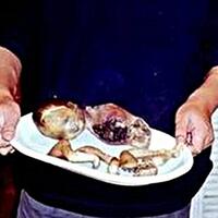 diana-mahasiswi-cantik-pemakan-janin