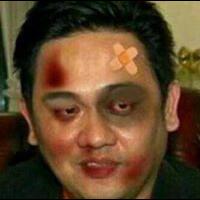 makin-seru-hotman-sediakan-duit-250-juta-untuk-hadiah-tinju-farhat-vs-al