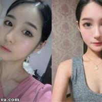 kumpulan-foto-before---after-orang-korea-gan-gile-banget-perbedaannya
