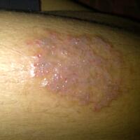 help-luka-kena-meja-jadi-begini