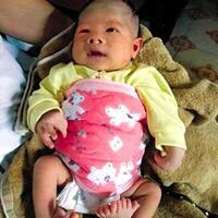 bayi-bayi-dengan-keanehan-paling-ajaib-di-dunia-with-pic