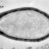 tidur-selama-30000-tahun-sebuah-virus-kuno-bangkit-kembali