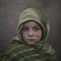 potret-anak-anak-korban-peperangan-dan-perselisihan-di-afghanistan