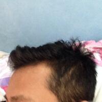 helprambut-gua-rontok-hampir-botak-2---part-1