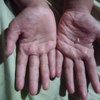 anda-bertanyadr-coass-mhsw-fkorg-medis-menjawab