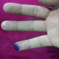 bagaimana-merubah-kesialan-menjadi-keberuntungan-dengan-penghapusan-energi-negatif