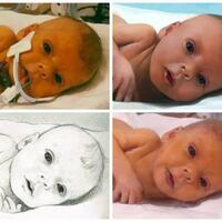 bayi-ini-hidup-tinggal-6-minggu-lagi-karna-tumor-hati-dan