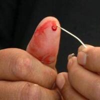 pertolongan-pertama-pada-stroke