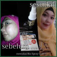 biospray-gold---100-alami---produk-booming-join-skg-juga