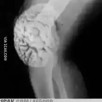 post-image
