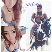 perlu-diketahui--8-negara-yang-paling-banyak-melakukan-operasi-plastik