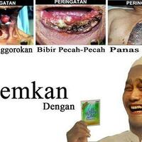 5-gambar-peringatan-di-kemasan-rokok-bonus-plesetannya-d