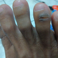 anda-bertanyadr-coass-mhsw-fk-paramedis-menjawab---part-1