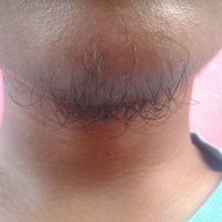 group-brewok-quotbrengozerquot-forum-resmi-berbagi-informasi-progress-hair-facial