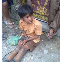 sebarkan-info-ini-anak-berbaju-pramuka-dipasung-dilaporkan-hilang-8-bulan
