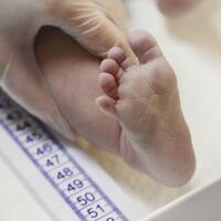 tiket-menuju-surga-balita-perempuan-kembar-dempet-butuh-bantuan