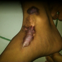 kenapa-kaki-ane-gan