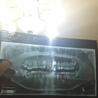 klinik-konsultasi-online-kesehatan-gigi--mulut-oleh-drg-diverboy