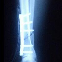 share-info-serba-serbi-yamaha-mio-mkc---part-9