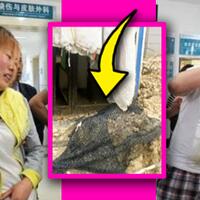 tragis-gardu-listrik-disangka-toilet-bocah-ini-kesetrum-10-ribu-volt