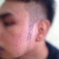 group-brewok-quotbrengozerquot-forum-resmi-berbagi-informasi-progress-hair-facial