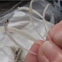 sangkut-tulang-ikan-bagaimana-lihatlah-cara-ini