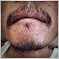 group-brewok-quotbrengozerquot-forum-resmi-berbagi-informasi-progress-hair-facial