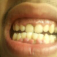 klinik-konsultasi-online-kesehatan-gigi--mulut-oleh-drg-diverboy