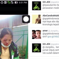 ini-foto-wajah-gojek-wanita-yang-bonyok-gojek-diserbu-pertanyaan