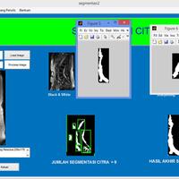 ask-menggabungkan-2-hasil-segmentasi-kedalam-satu-axes--hasil--matlab