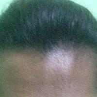 help-rambut-rontok-dan-menipis