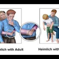 tersedak-bakso-pns-ini-meregang-nyawa