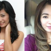 pict-wowini-wajah-baru-oplas-bunga-zaenal