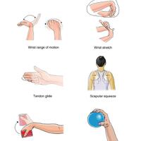 terapi-carpal-tunnel-syndrom-cts