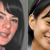 5-perubahan-pada-wajah-artis-indonesia-yang-mencengangkan