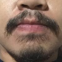 group-brewok-quotbrengozerquot-forum-resmi-berbagi-informasi-progress-hair-facial