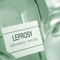 fakta-fakta-soal-penyakit-kusta-yang-wajib-anda-ketahui