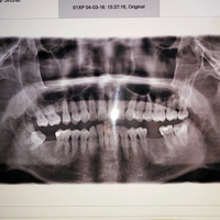 klinik-konsultasi-online-kesehatan-gigi--mulut-oleh-drg-diverboy