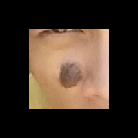 help-me-brayy-tanda-lahir---nevus---tompel-ane-kebesaran-hiks