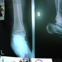 post-image