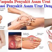 anda-kena-asam-urat