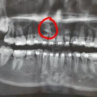 post-image