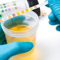 5-alat-pembayaran-teraneh-di-dunia-dari-keju-hingga-air-kencing