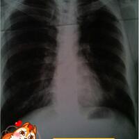 post-image