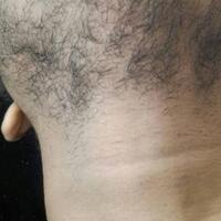 group-brewok-quotbrengozerquot-forum-resmi-berbagi-informasi-progress-hair-facial