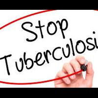 lomba-survive-melawan-tuberkulosis