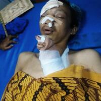 begal-cirebon-kembali-minta-korban-tiga-jari-putus-disabet-golok